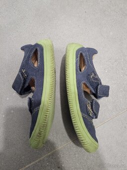 Protetika sandálky - 3