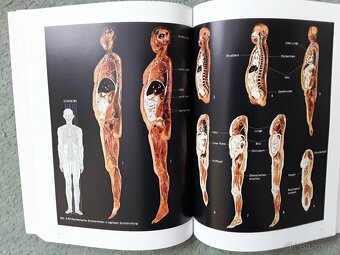 Výstavní katalog KÖRPERWELTEN-Prof.G.HAGENS - 3
