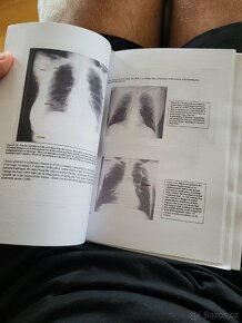 X-RAY Book (Jak číst rentgen) - 3