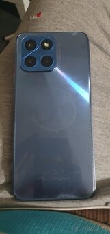 Honor 6x VNE-LX1 - 3