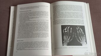 Klinická revmatologie - 3