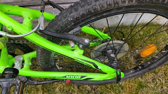 CTM JERRY 1.0 20 dětské kolo - 3