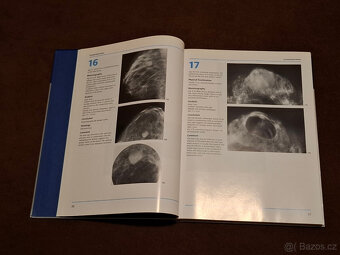 Lékařská kniha: Teaching Atlas of Mammography (v angl.jaz.) - 3