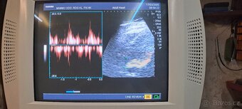 Ultrazvuk/sonograf Toshiba Nemio - 3
