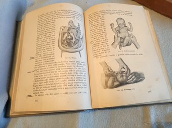 Učebnice pro porodní asistentku - 3