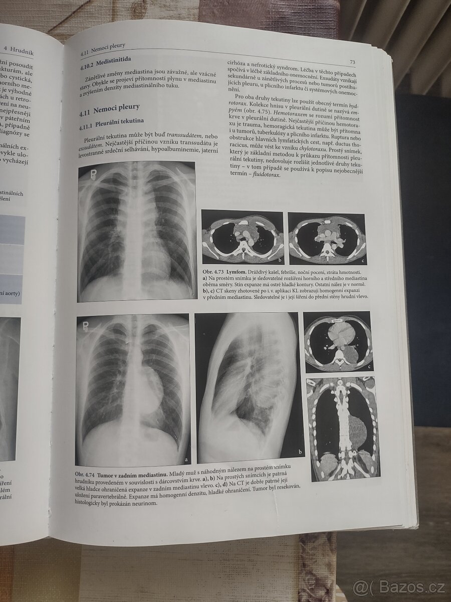 Základy radiologie - 4