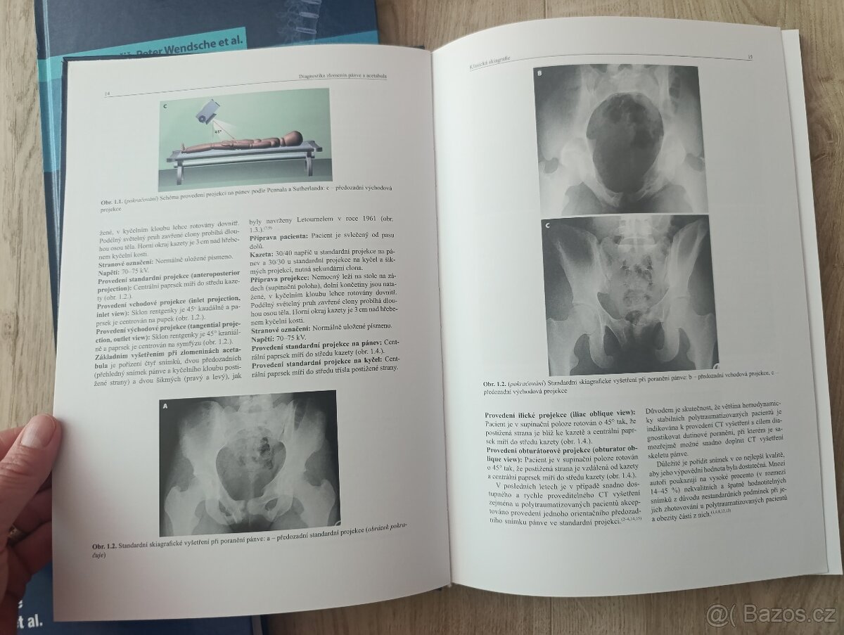 Poranění páteře, Diagnostika zlomenin pánve a acetabula - 4