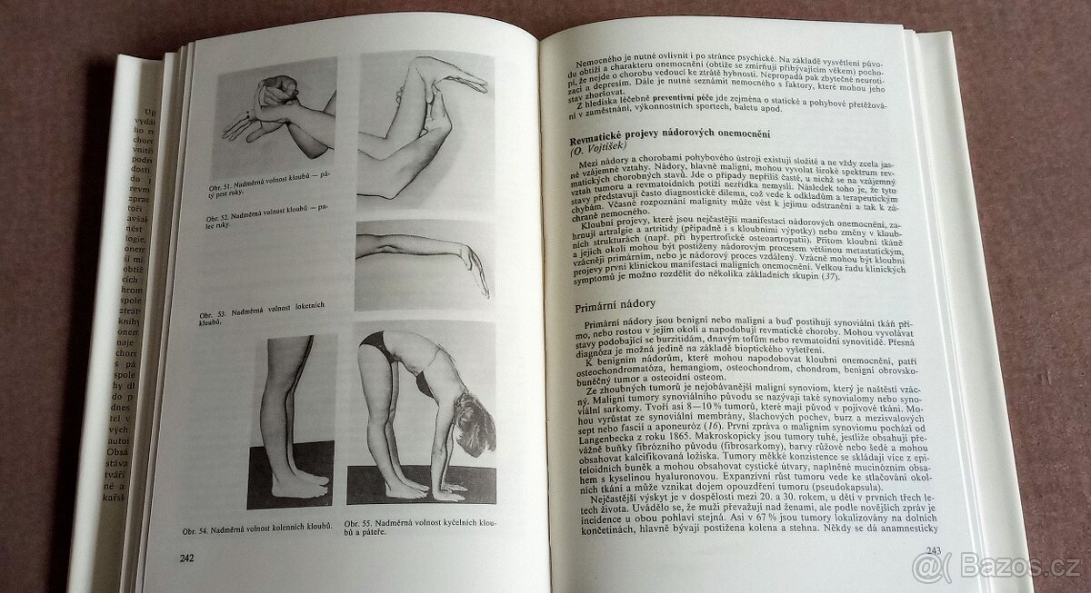 Klinická revmatologie - 4