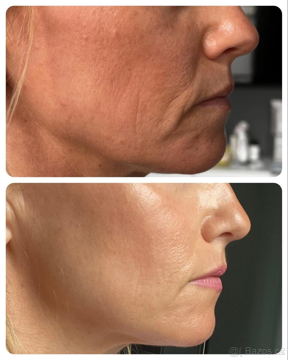 AKCE NuSkin - AgeLOC Line Corektor - 4