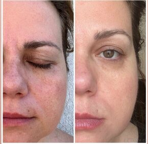 Collagen + Vitamin C sérum pumps - 4