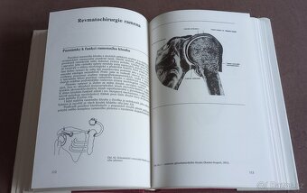 Revmatochirurgie - 4