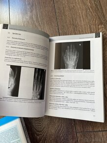 Radiologie pro studium i praxi - 4