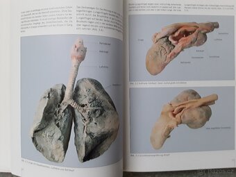 Výstavní katalog KÖRPERWELTEN-Prof.G.HAGENS - 4