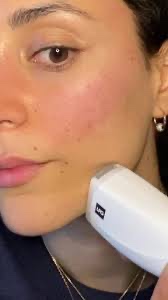LPG endermologie na doma/wellbox - 4