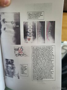 X-RAY Book (Jak číst rentgen) - 4