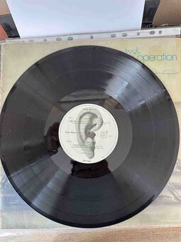 LP Birth Control - Operation - 4
