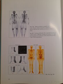 Atlas kostní scintigrafie - 4