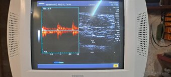 Ultrazvuk/sonograf Toshiba Nemio - 4