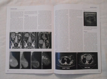 Časopis Urologie pro praxi 4 / 2024 - 4