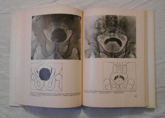 Václav Pačes - Urologie - 1979 - 4