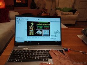 zdravotní diagnostický přístroj - 4