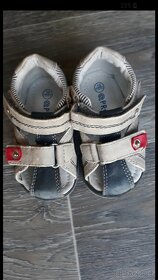 Sandálky protetika - 4