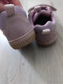 Celoroční boty protetika - 4