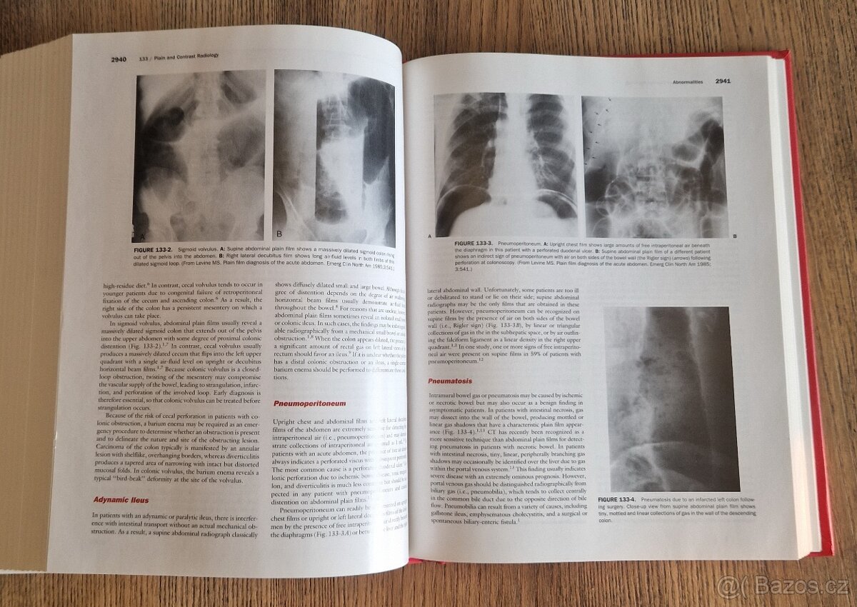 Textbook of Gastroenterology Volume two (EN, 1999) - 5
