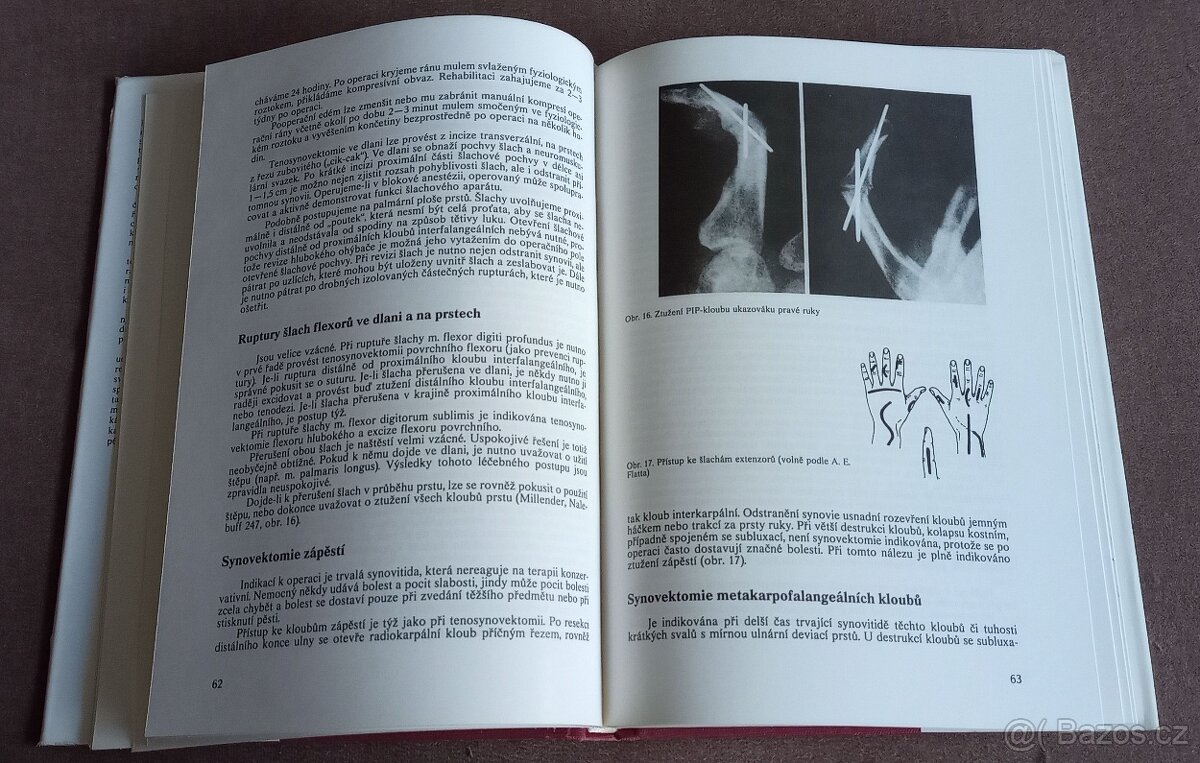 Revmatochirurgie - 5