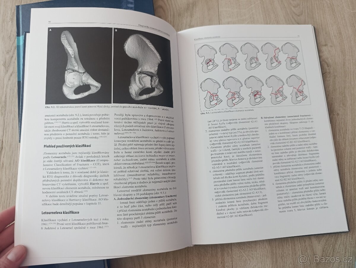 Poranění páteře, Diagnostika zlomenin pánve a acetabula - 5