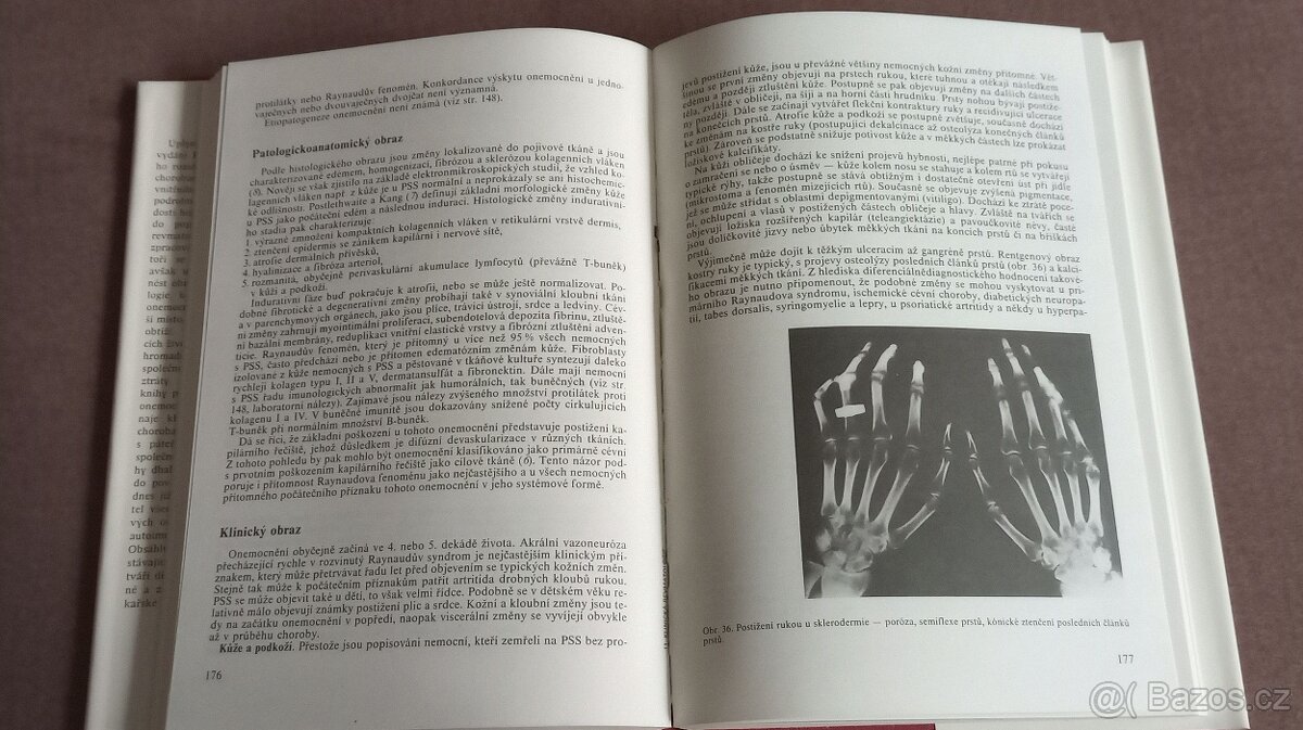 Klinická revmatologie - 5