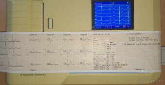 EKG přímopíšící - 5