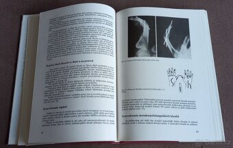 Revmatochirurgie - 5