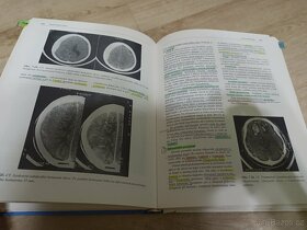 Radiodiagnostika kapitoly z klinické praxe Vyhnánek - 5