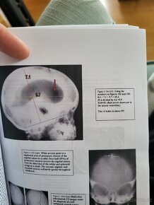 X-RAY Book (Jak číst rentgen) - 5