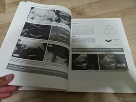 Manuál ultrazvukové diagnostiky Palmer - 5