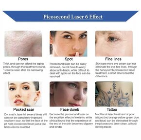 Víceúčelový laser na odstranění tetování - Picosecond - 5