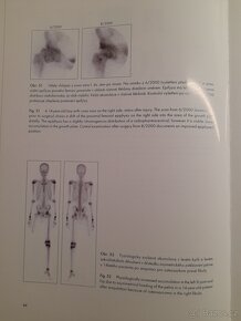 Atlas kostní scintigrafie - 5