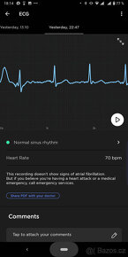 Francouzské chytré hodinky - měří EKG - nové - 60% sleva - 5