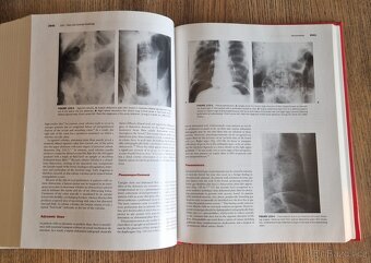 Textbook of Gastroenterology Volume two (EN, 1999) - 5