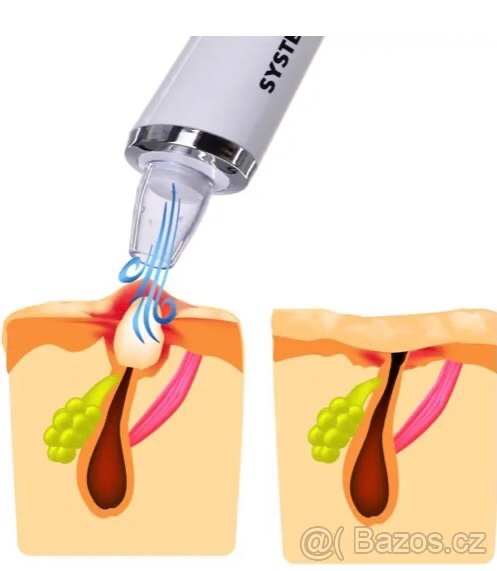 Přístroj k čištění pleti - 6