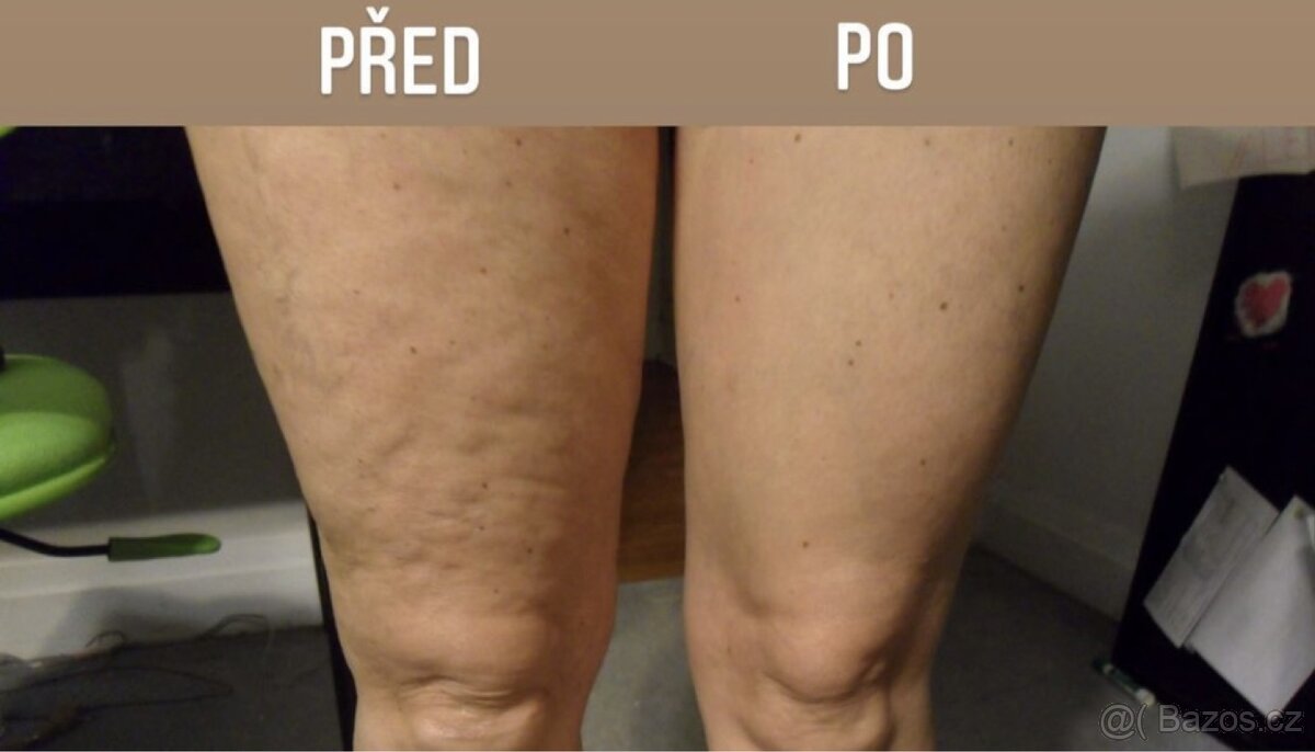 Galvanická zehlicka na tělo Nuskin - galvanic spa - 6