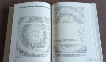 Revmatochirurgie - 6