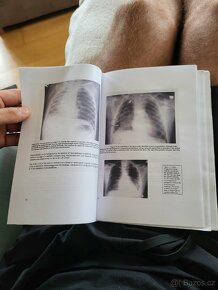 X-RAY Book (Jak číst rentgen) - 6