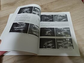 Manuál ultrazvukové diagnostiky Palmer - 6