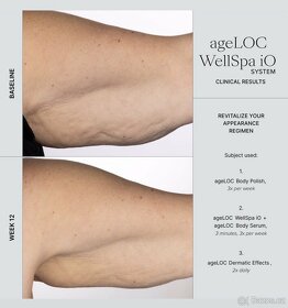AKCE NuSkin - Well Spa iO sada - 6