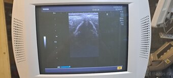 Ultrazvuk/sonograf Toshiba Nemio - 6