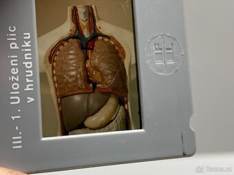 diapozitivy staré diapozitivy tělo lékařství promítačka - 6
