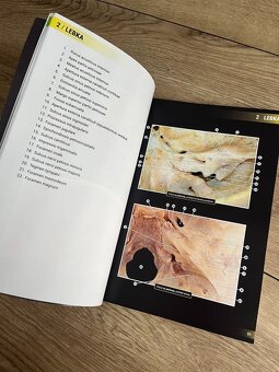 Atlas vybraných kapitol anatomie člověka - 6