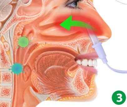Stop chrápaniu a alergiám - 7